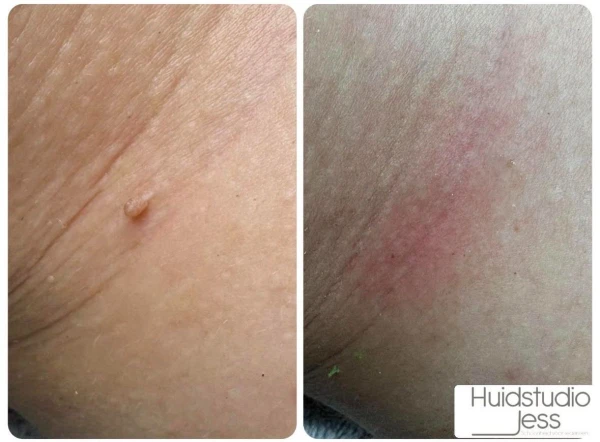 Steelwratjes nijkerk